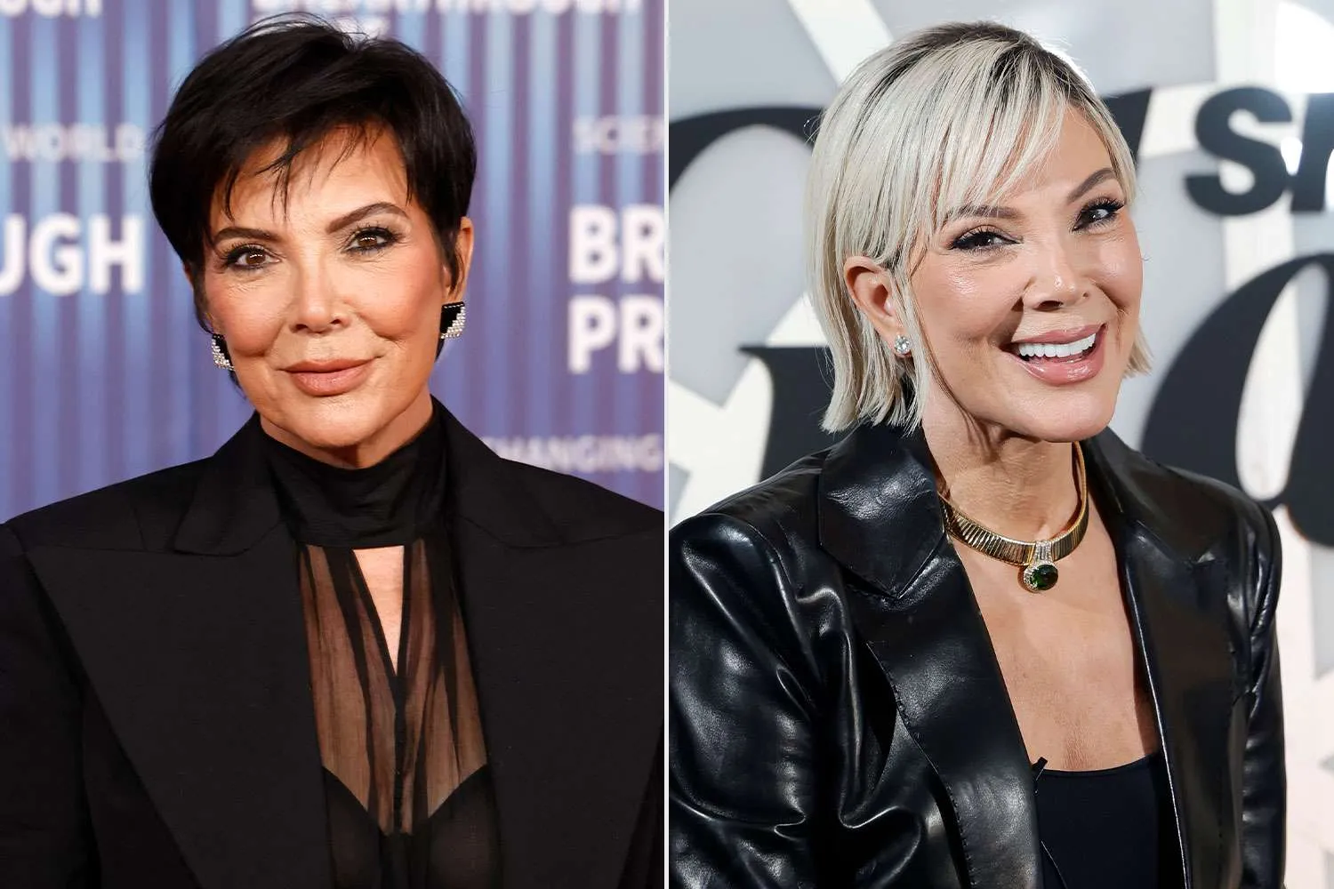 Kris Jenner Face Lift